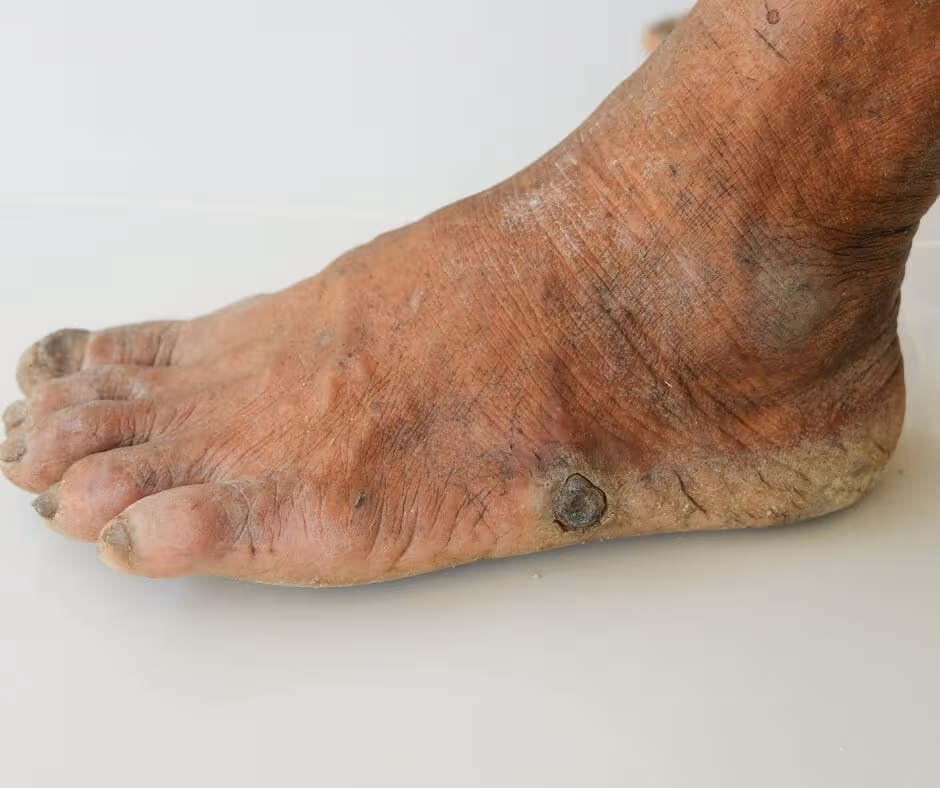 Potential Side Effects and Precautions