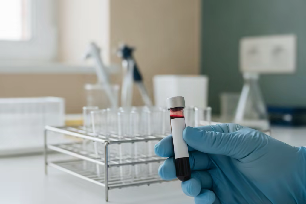 A gloved hand holding a labeled blood sample vial in a laboratory