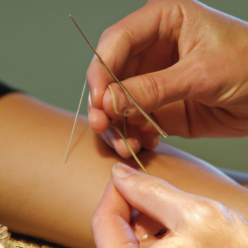 The Role of Acupuncture in Addiction Recovery-The Benefits of Acupuncture in Addiction Recovery, 